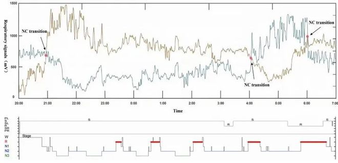 新方法新器械！上海交通大学在睡眠期间可穿戴实时鼻周期监测取得重大进展星空体育官网(图3)